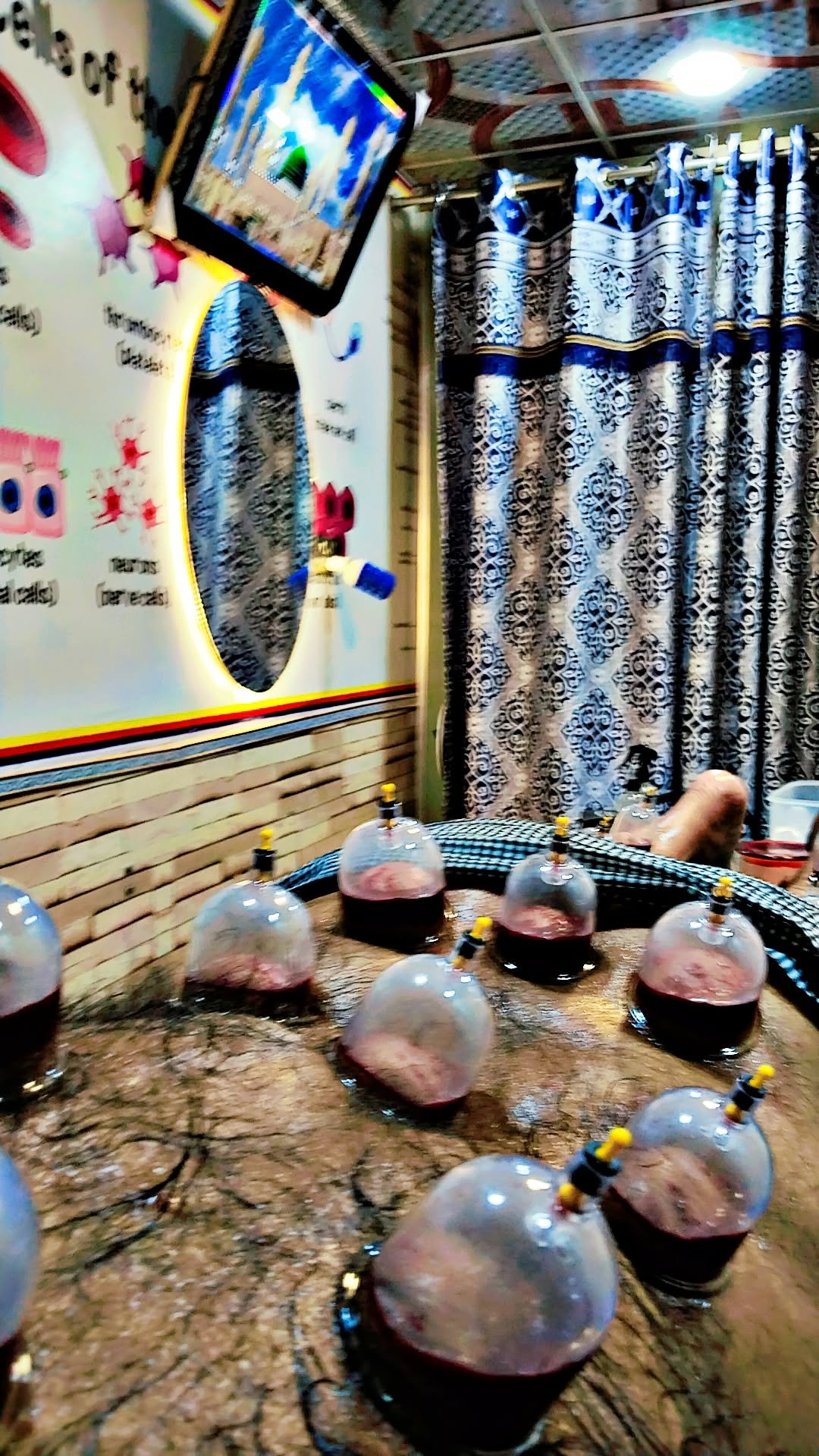 Hijama Clinic